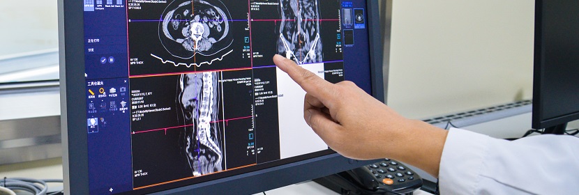 工業CT無損檢測