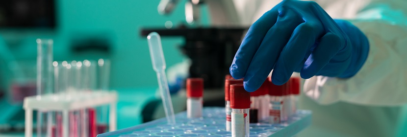 氯烴基硅烷偶聯(lián)劑檢測