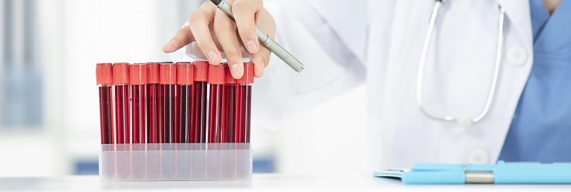 四苯硼鈉檢測(cè)