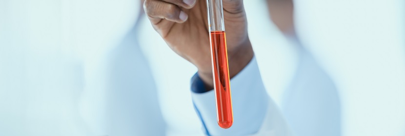 硫化促進(jìn)劑ZEHBP檢測